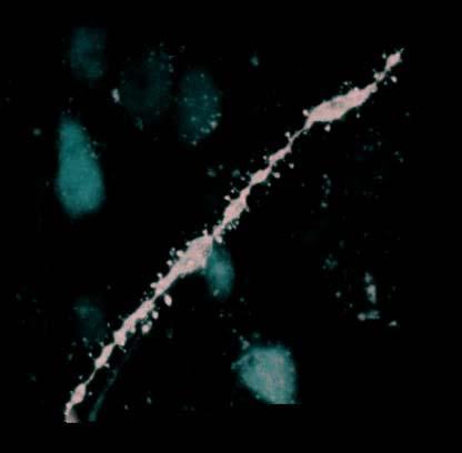 Imaging complex structures Dendritic spines in mouse