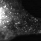 Endosome migration in living cells imaging a