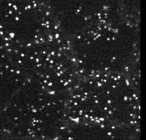 Transferrin labeled endosomes migrating around an MDCK cell Perkin-Elmer/Yokagawa