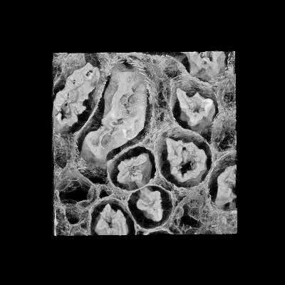 3D imaging of kidney