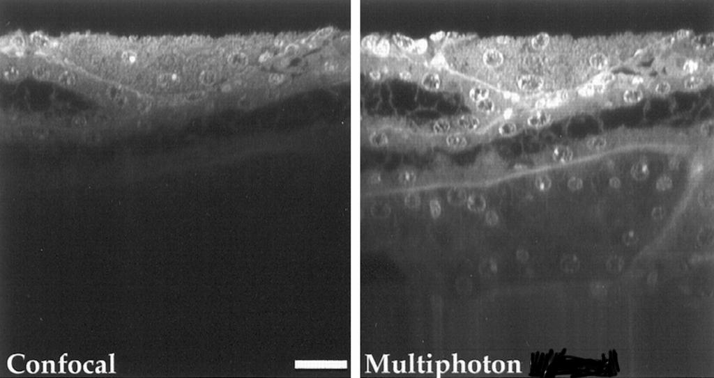 Multi-photon Excitation Allows Deeper Imaging in Intact