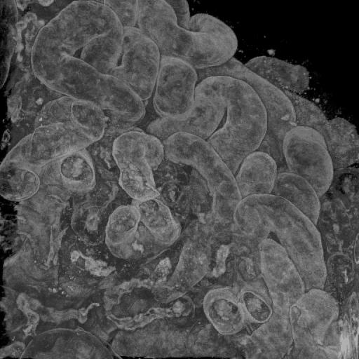 Imaging complex structures Kidney tubules of a newborn
