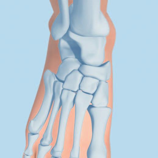Locking Navicular Plate 1 Approach Make a dorsal longitudinal incision from the midneck of the talus towards the base of the second