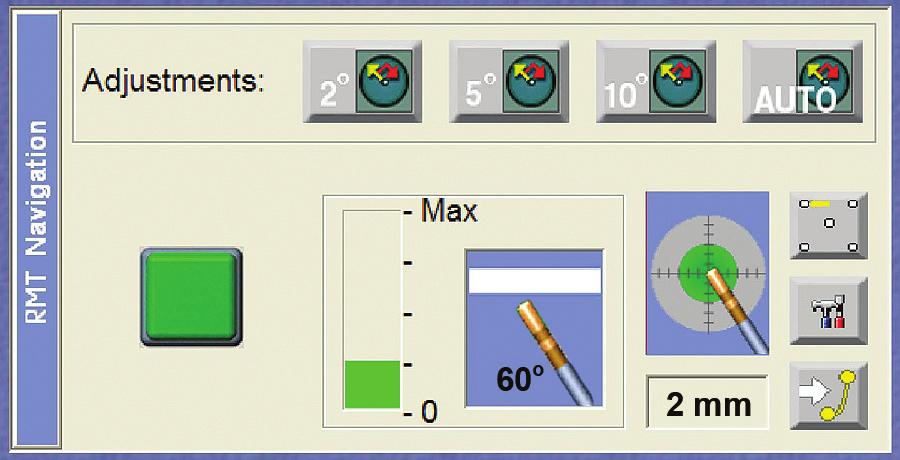 Using NaviLine During this process, monitor the distance to target (A) on the RMT panel, as well as the target icon (B).