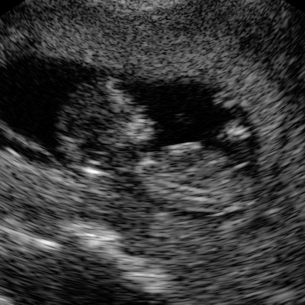 In vivo image of fetus 3 4 5 6 7 8 9 4 Fig. 5. 3 3 4 Original image of fetus in the 9th week.