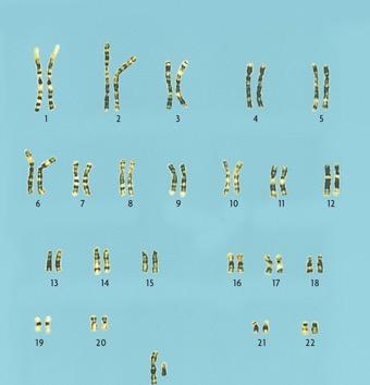 Karyotypes A karyotype is a picture of all the chromosomes in a cell Karyotypes can be used to detect genetic