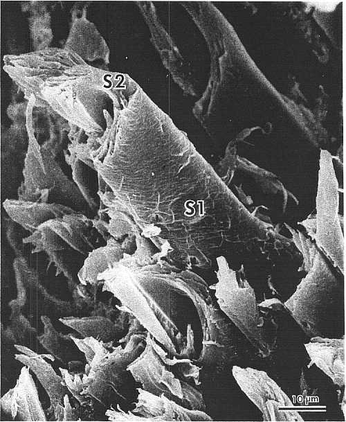 Oearly, intrawall failure predominates as Sl and 82 microfibrillar orientation can be seen throughout the micrograph.
