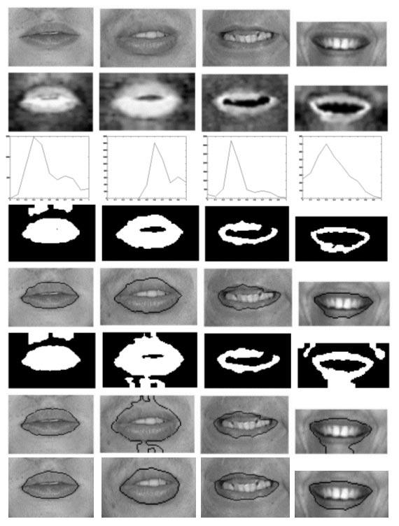 546 IEEE TRANSACTIONS ON FUZZY SYSTEMS, VOL. 11, NO. 4, AUGUST 2003 Fig. 3. Lip segmentation using the hue filtering (HFS) algorithm [11] and the fuzzy entropy histogram thresholding (FEHT) [7].