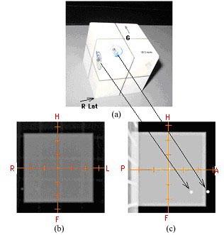 275 Guan et al.: Positioning QA for radiotherapy image matching 275 Fig. 1: (a) the cube phantom with 2 bbs placed on the surface; (b) the AP MV image; (c) the R Lat kv image.