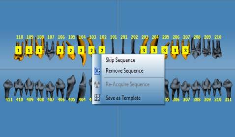 Skip sequence during acquisition To skip a sequence during acquisition Right click on a sequence and select menu option Skip