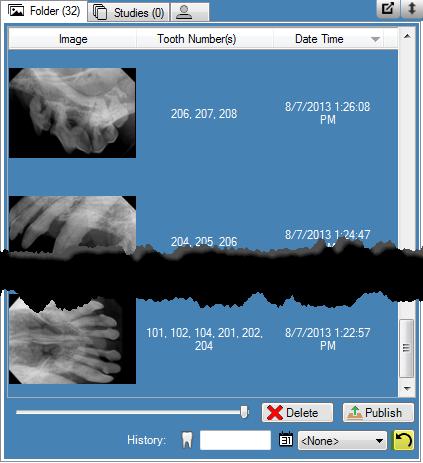 To Filter Images by History of a Tooth Numbers 1.