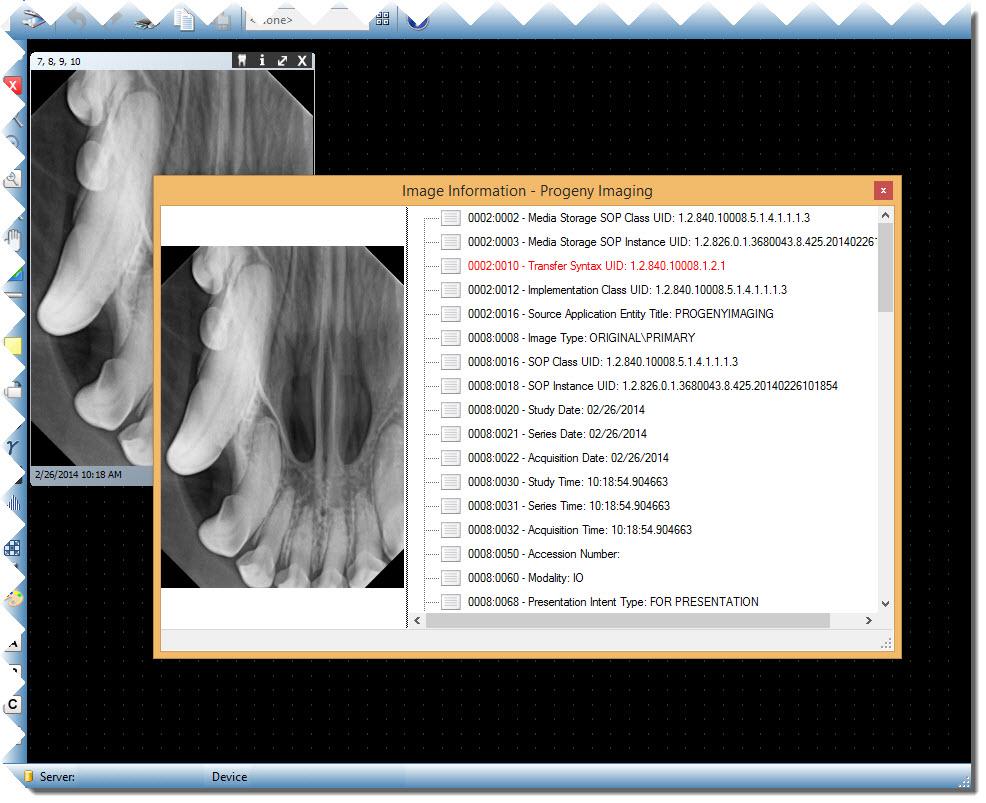 Displaying an Image's DICOM Information X-ray images acquired with Progeny Imaging Veterinary are stored in DICOM format. You can view an image's DICOM information. To Display Image Information 1.
