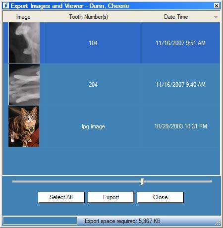 To Export DICOM Images 1. Open a patient record. 2. Select Patient > Export Patient Images to open the Export Images and Viewer screen. The screen shows all the images in the patient's record.