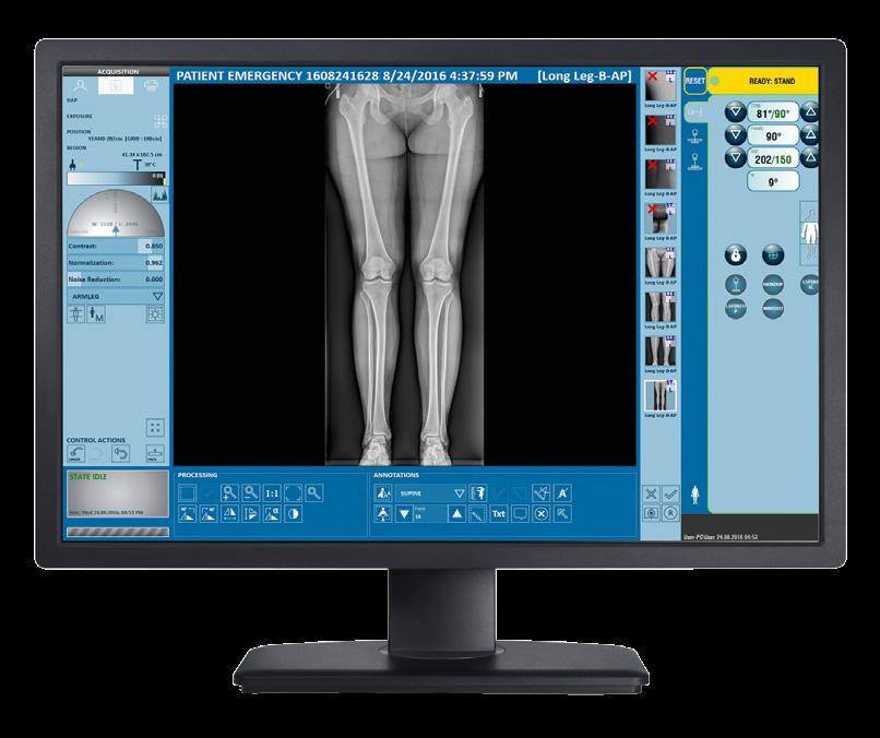 Featuring ddraura s stitching function, it utilizes a single focus stitching technique for orthopedic studies such as scoliosis and long leg imaging.
