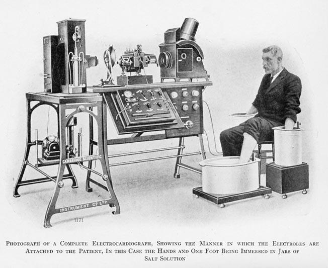 History of ECG Willem Einthoven The clinical use of Einthoven's immobile equipment required transtelephonic