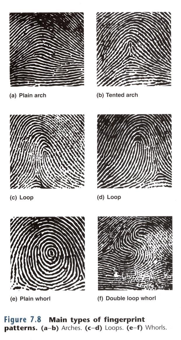 Activity 6: Dermography: Fingerprinting As noted on page 70, each of us has a unique genetically determined set of fingerprints.