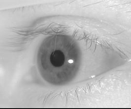 It is evident that the affine transformation outputs an image with more circular pupillary and limbic iris boundaries which can be detected by conventional orthogonal iris recognition algorithms.