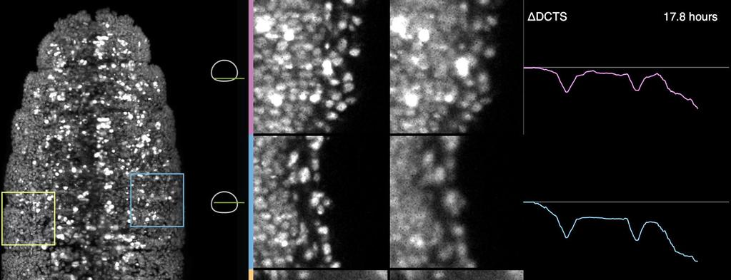 Supplementary Video 3 Recovery of high spatial resolution in Drosophila adaptive imaging Quality comparison of corrected and uncorrected time-lapse image data for the spatiotemporally adaptive