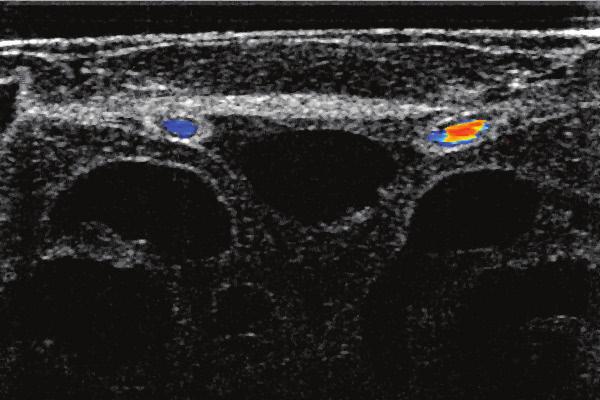 Optical Coherence Tomography: Imaging Capabilities Imaging a Mouse