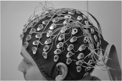 Normal EEG signals a quiet environment is required only one person should be in the room with the patient wide-awake normal persons produce an unsynchronized highfrequency EEG rhythmic