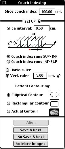 In the case of stereotatcic brachytherapy, we would have selected "Fiducials" as the coordinate determination method and the Frame type item would be active with a pop-up menu showing the available