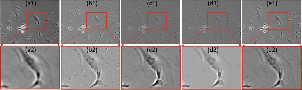 Refocusing Phase Contrast Microscopy Images 69 Fig. 4. Refocusing F. (a) Defocused phase contrast image. (b) Result without SPG in Eq. 5. (c) Result without SPDC in Eq. 5. (d) Result by Eq. 5. (e) Result by Eq.