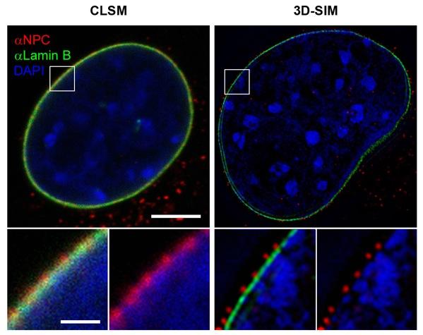 3D-SIM resolves chromatin domains and interchromatin channels, leading towards nuclear pores CLSM 3D-SIM 5 µm 1 µm Mouse