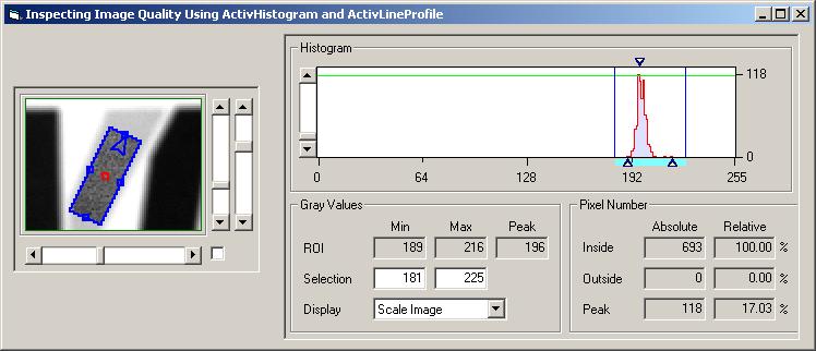 4.1 Analyzing Image Quality 47 1 ActivView 2 Figure 4.