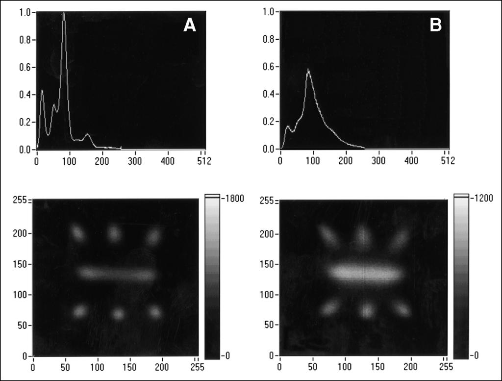 FIGURE 7. (A) Energy spectrum and image with signal-remnant subtraction activated. (B) Energy spectrum and image without signal-remnant subtraction.