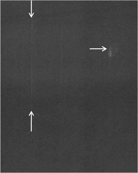(a) (b) Figure 4: Artefacts caused by (a) dust on part of an imaging plate, (b) scrapes on the imaging plate (horizontal arrow) and dust in the CR reader optics (vertical arrows).