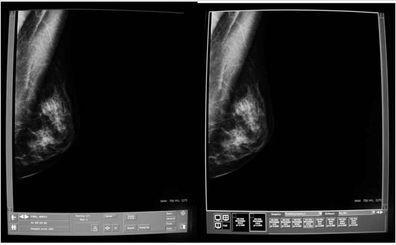 Figure 8: Radiologist s workstation with the same clinical image displayed on both monitors.