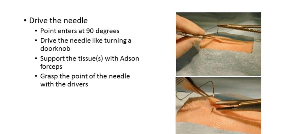 Always support the tissues with forceps when driving a needle through them. Always use forceps never your fingers!