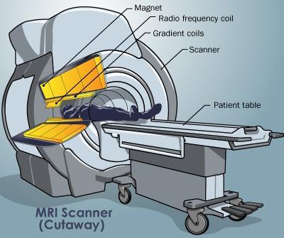 Different Part of MRI System Magnet :