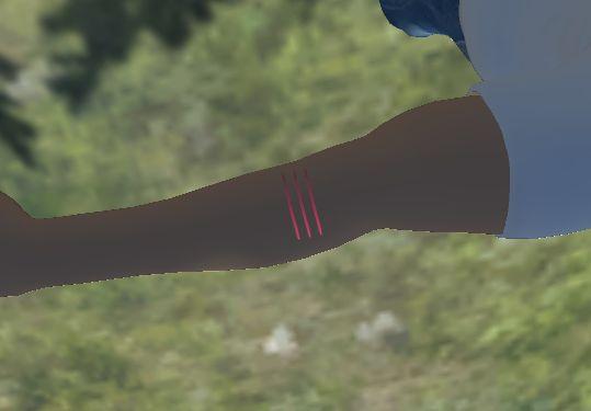 Wound and Treatment In the task of first-aid treatment, wound shows on the lower arm of the player character. To visualize this, a cylinder was externally added to the gameobject of the character.