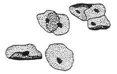 Look for two components in the cytoplasm: the small block dots called ribosomes give the cytoplasm its granular appearance; the nucleoid, a relatively electron-transparent region (appears light)