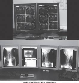 Now, as radiologists have become more comfortable, the number of monitors has dropped to an