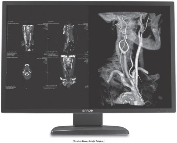Most cross-sectional imaging is read on a 1K square monitor.