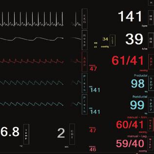 Tablet to display vital signs Customize each trace independently; users can set alarms,