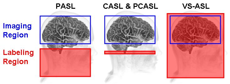 Figure 4. The different labeling scheme for a variety of ASL preparation sequences. Pulsed ASL (PASL) saturates or inverts a slab of spins (stationary and moving) proximal to the imaging region.