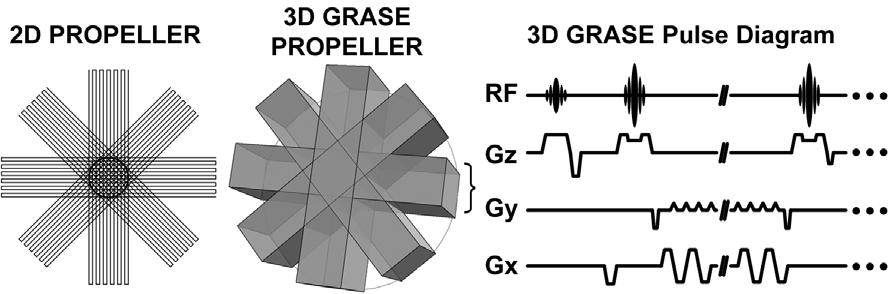 Figure 9. (a) The schematic illustration of k-space trajectory for 2D PROPELLER (left) and 3D GRASE PROPELLER (right).