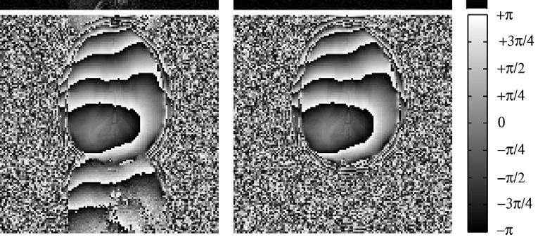 An image-domain comparison of the pmri calibration data available in the method, with both magnitude (top) and phase (bottom) images shown.