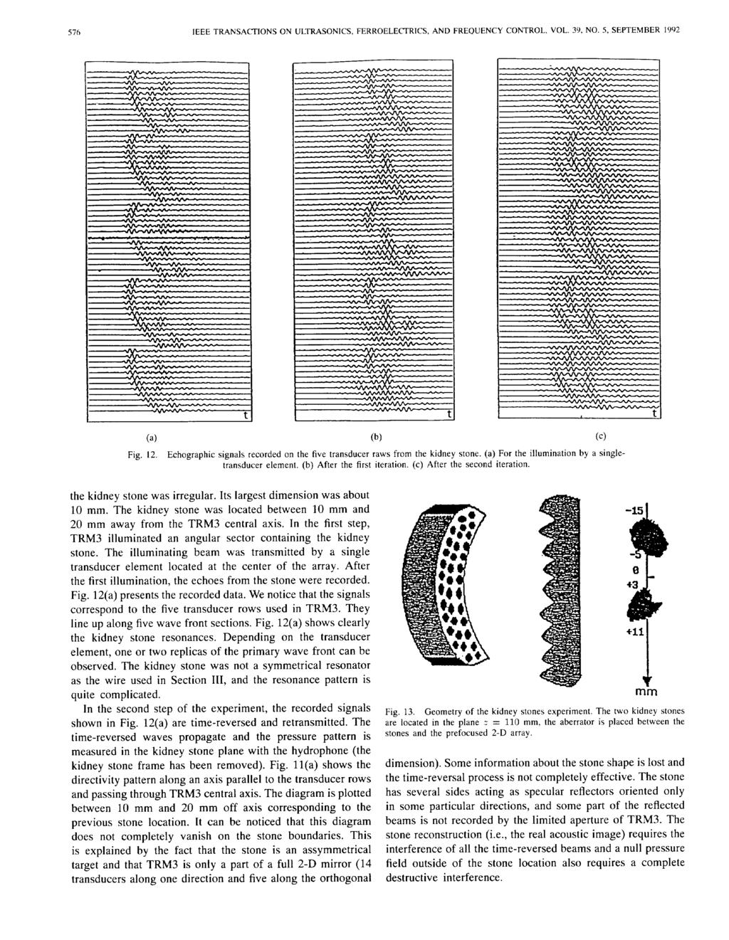 S76 IEEE TRANSACTIONS ON ULTRASONICS, FERROELECTRICS, AND FREQUENCY CONTROL, VOL. 39, NO. 5, SEPTEMBER 1992 (a) (b) (c) Fig. 12.
