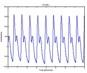 Figure 10: PPG signals from commercial heart rate monitor 1 Figure 11: PPG signals from commercial heart rate monitor 2 Results are compatible with other PPG signals from current available heart rate