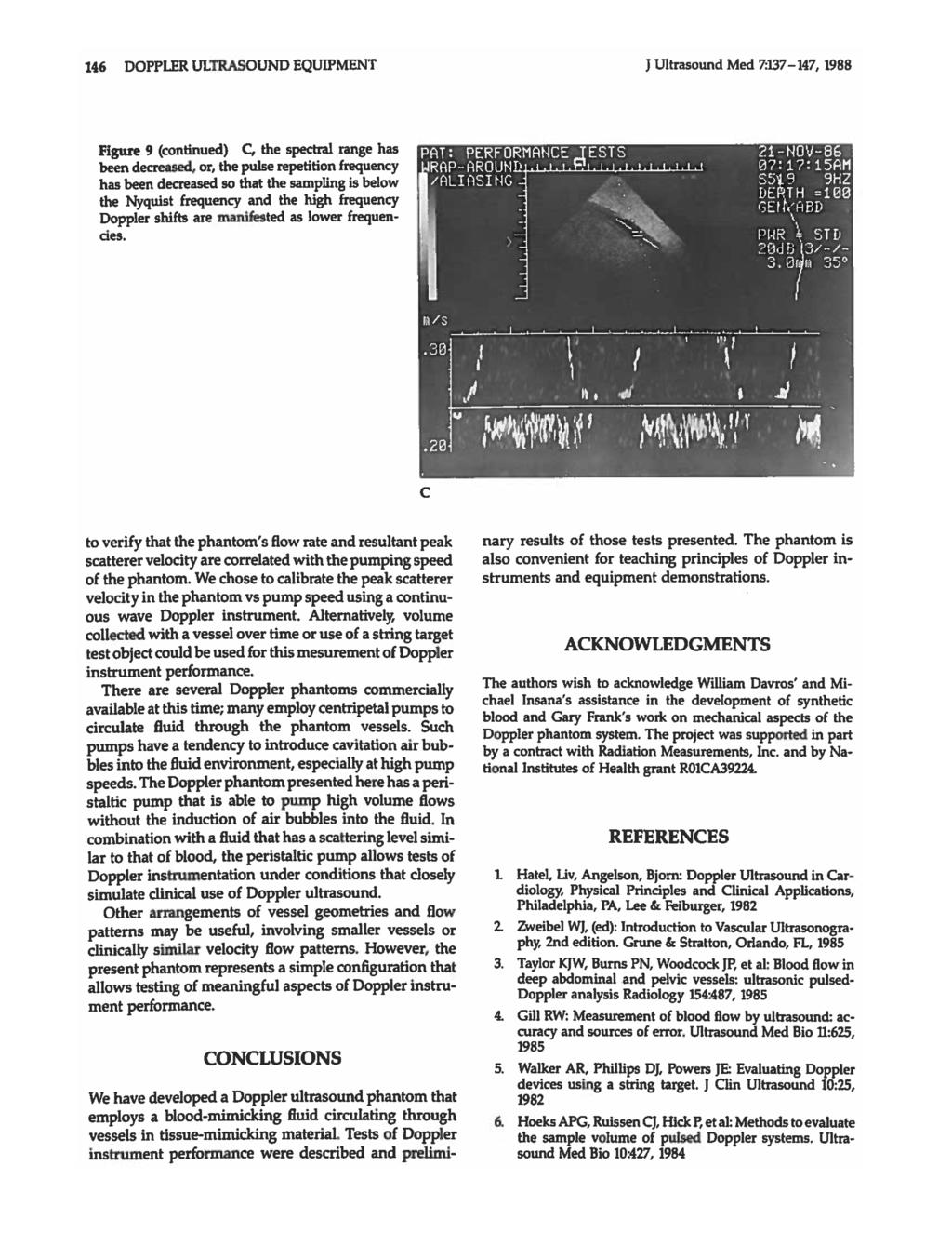 146 DOPPLER ULTRASOUND EQUIPMENT J Ultrasound Med 7:137-147, 1988 Figure 9 (continued) C, the spectral range has been decreased.