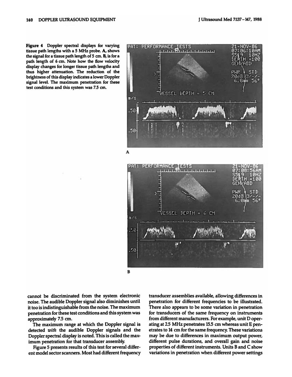 140 DOPPLER ULTRASOUND EQUIPMENT J Ultrasound Med 7:137-147, 1988 Figure 4 Doppler spectral displays Cor varying tissue path lengths with a S MHz probe.
