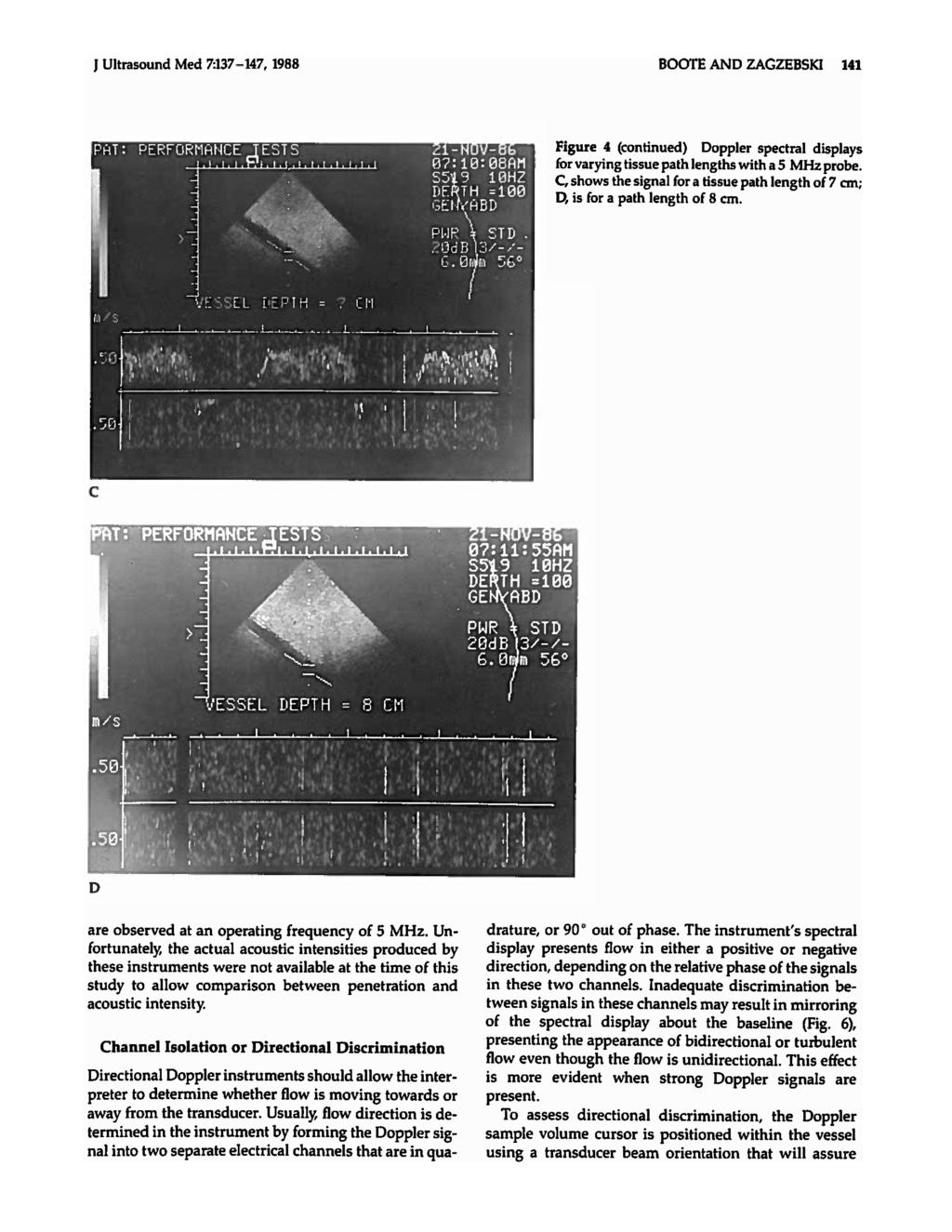 J Ultrasound Med 7:137-147, 1988 BOOTE AND ZAGZEBSKI 141 Figure 4 (continued) Doppler spectral displays for varying tissue path lengths with a 5 MHz probe.