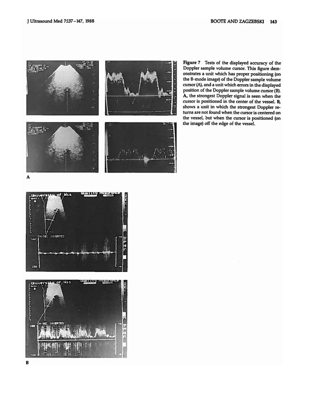 J Ultrasound Med 7:137-147, 1988 BOOTE AND ZAGZEBSKI 143 Figure 7 Tests of the displayed accuracy of the Doppler sample volume cursor.