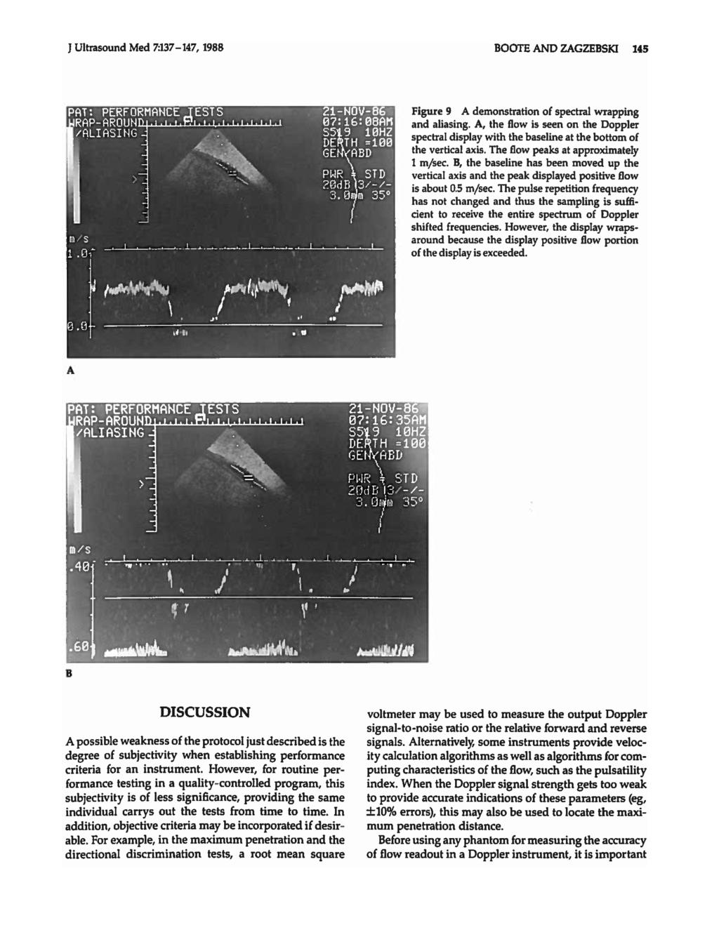 J Ultrasound Med 7:137-147, 1988 BOOTE AND ZAGZEBSKI 145 Figure 9 A demonstration of spectral wrapping and aliasing.