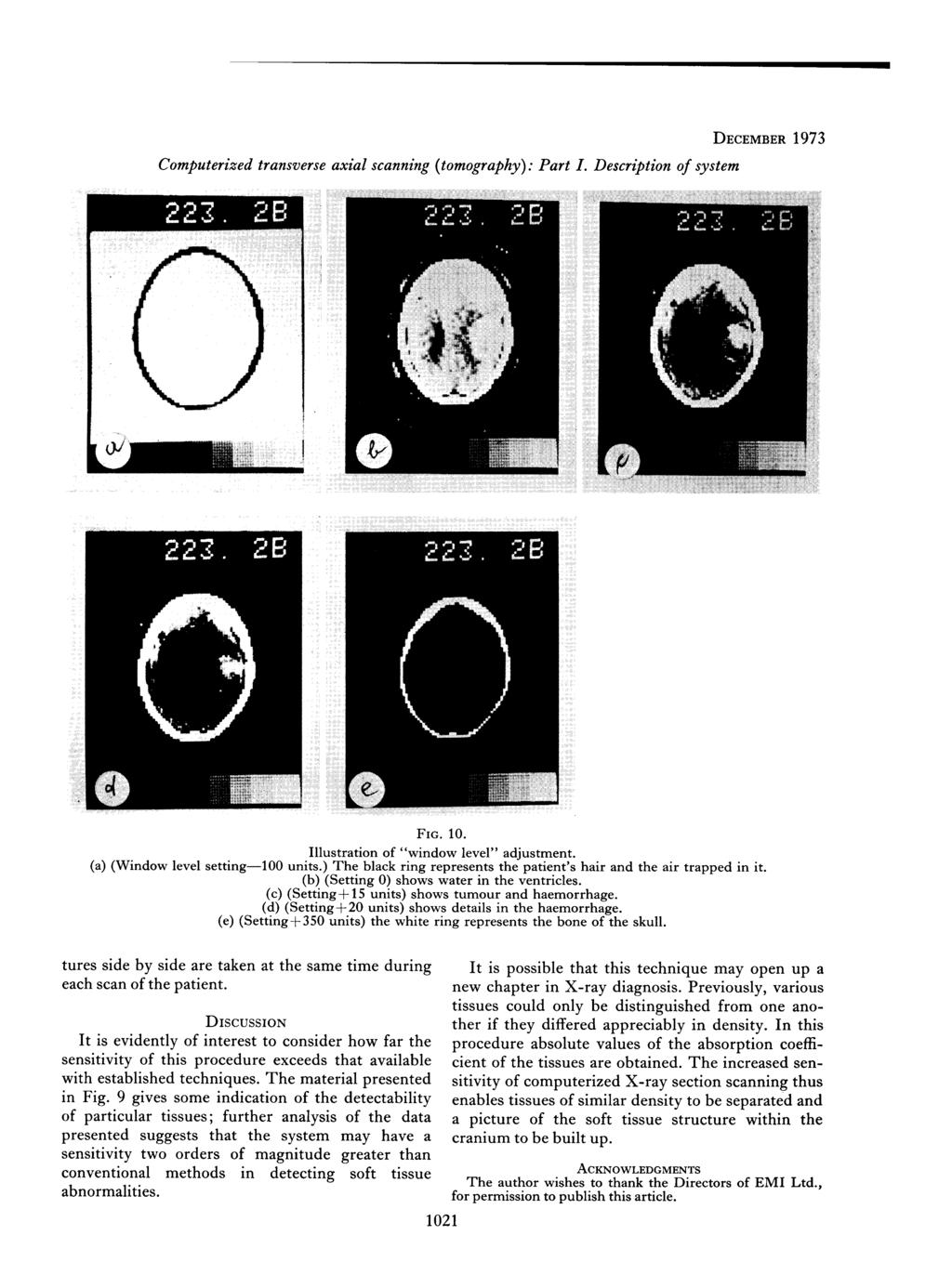 Computerized transverse axial scanning {tomography): Part I. Description of system DECEMBER 1973 FIG. 10. Illustration of "window level" adjustment, (a) (Window level setting 100 units.