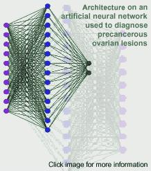 Artificial Neural